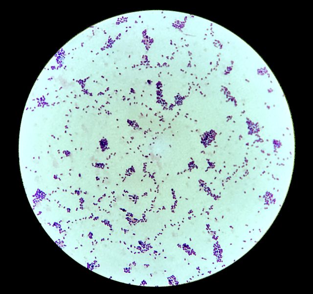 S. pneumoniae 7049_0000