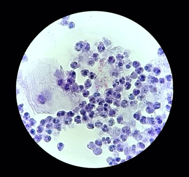 trial mix 3b FB negative sputa_0007